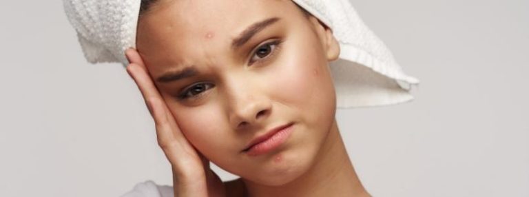 Does Phentermine Cause Acne?